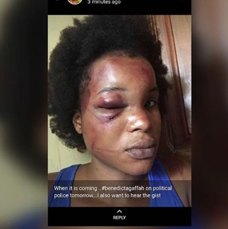 How Benedicta Gafah Got Abused By Her Married Boyfriend