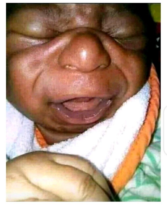 Man refuted hospital bills because his child is too ugly