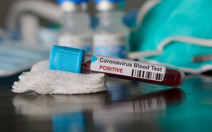 Coronavirus cases in Nigeria rises to 12