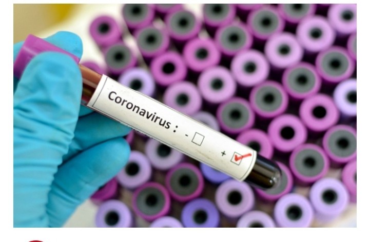 COVID-19 cases rise to 1,671 as 188 recover in Ghana