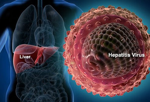 Hepatitis: Types, Causes, Effects On The Body, Treatment And Prevention