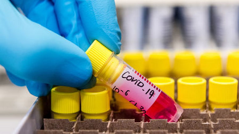 Ghana’s COVID-19 cases hit 5,408, recoveries now 514