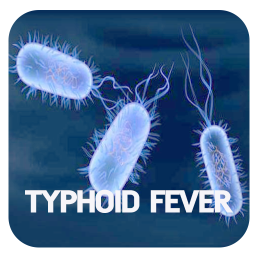 Typhoid Fever: Overview, Causes, Signs And Symptoms, Treatment and Prevention