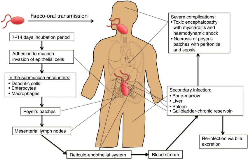 Typhoid Fever: Overview, Causes, Signs And Symptoms, Treatment and Prevention